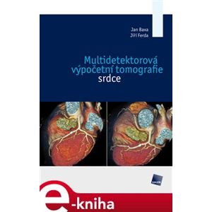 Multidetektorová výpočetní tomografie srdce - Jan Baxa, Jiří Ferda e-kniha