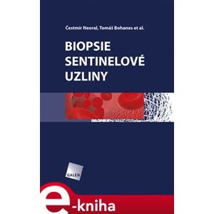 Biopsie sentinelové uzliny - Čestmír Neoral, Tomáš Bohanec e-kniha