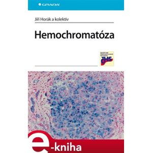 Hemochromatóza - Jiří Horák e-kniha