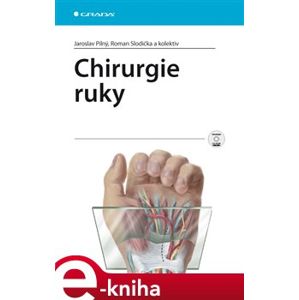 Chirurgie ruky - Jaroslav Pilný, Roman Slodička e-kniha