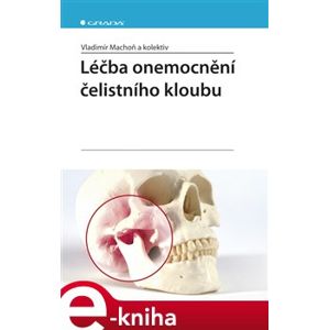 Léčba onemocnění čelistního kloubu - Vladimír Machoň e-kniha