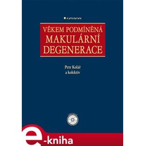 Věkem podmíněná makulární degenerace - Petr Kolář e-kniha