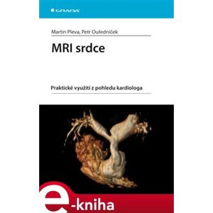 MRI srdce. Praktické využití z pohledu kardiologa - Martin Pleva, Petr Ouředníček e-kniha