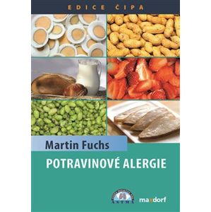Potravinové alergie - Martin Fuchs
