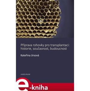 Příprava rohovky pro transplantaci - Kateřina Jirsová e-kniha