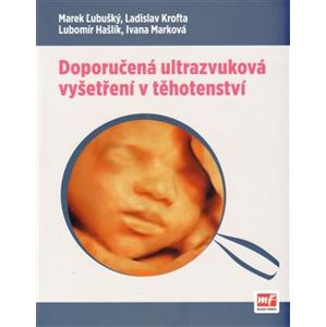 Doporučená ultrazvuková vyšetření v těhotenství - Marek Lubušký, Ladislav Krofta, Lubomír Hašlík, Ivana Marková
