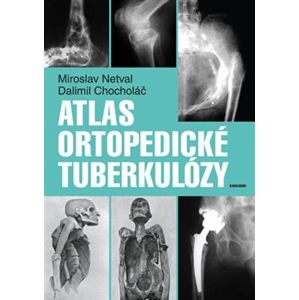 Atlas ortopedické tuberkulózy - Dalimil Chocholáč, Miroslav Netval