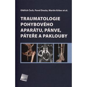 Traumatologie pohybového aparátu, pánve, páteře a paklouby - Pavel Douša, Oldřich Čech, Martin Krbec
