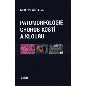 Patomorfologie chorob kostí a kloubů - Ivo Mařík, Alena Maříková, Martin Horák, Ctibor Povýšil