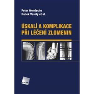 Úskalí a komplikace při léčení zlomenin - kol., Radek Veselý, Peter Wendsche