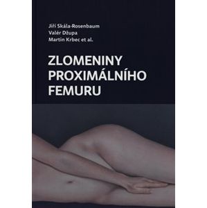 Zlomeniny proximálního femuru - Jiří Skála Rosenbaum, Valér Džupa, Martin Krbec