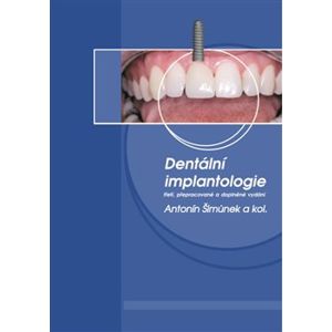 Dentální implantologie. třetí, přepracované a doplněné vydání - Antonín Šimůnek, kolektiv autorů