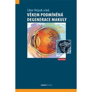 Věkem podmíněná degenerace makuly - Libor Hejsek