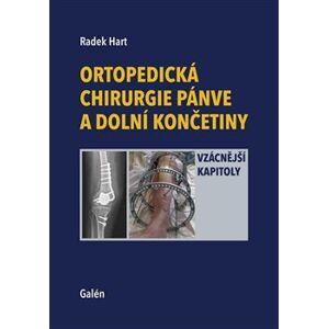 Ortopedická chirurgie pánve a dolních končetin - Radek Hart