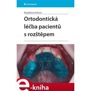 Ortodontická léčba pacientů s rozštěpem - Magdalena Koťová e-kniha